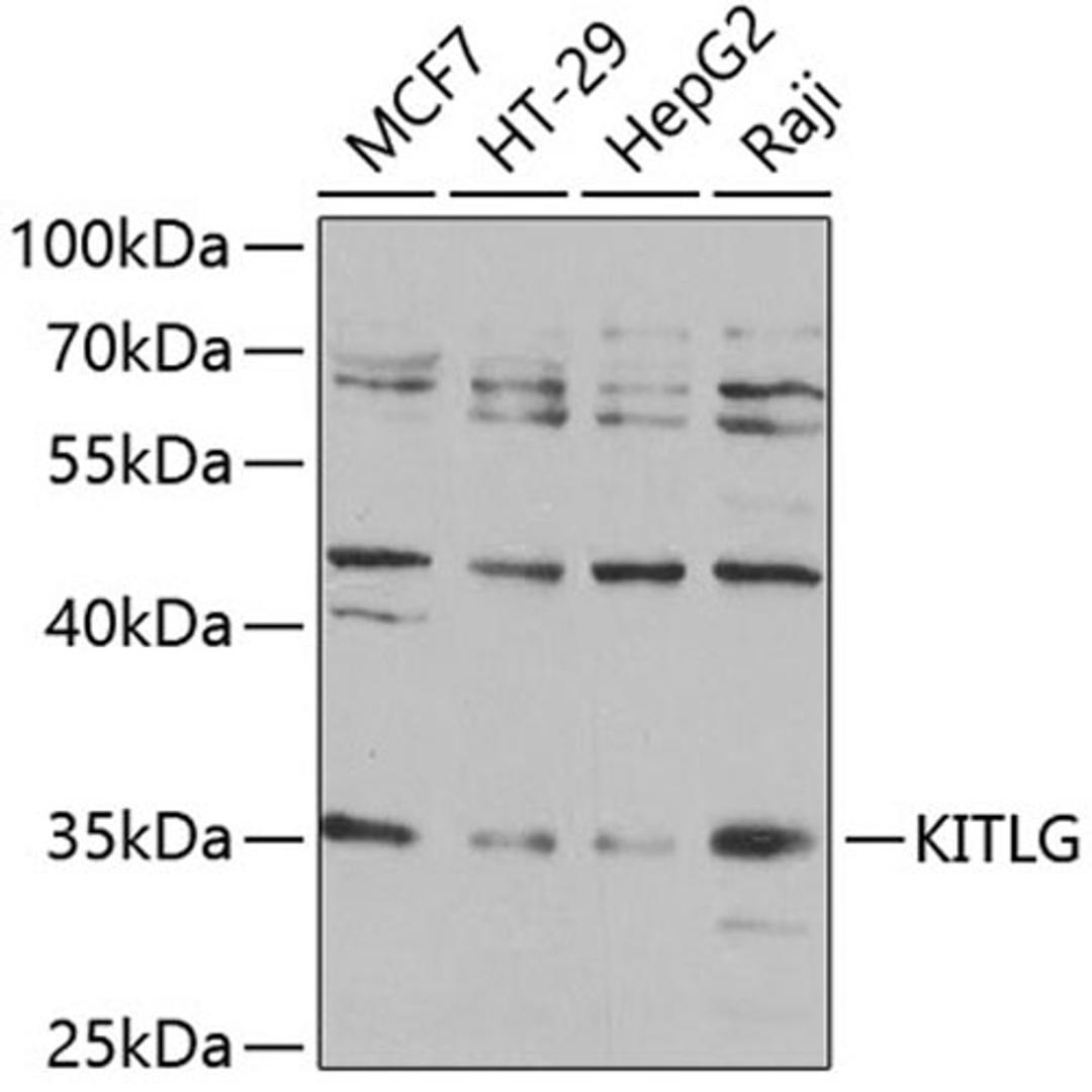 Western blot - KITLG antibody (A5672)