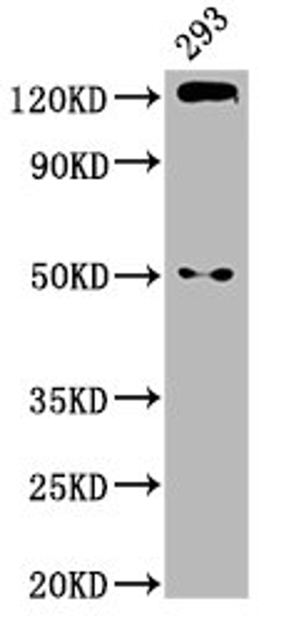 Western Blot. Positive WB detected in: 293 whole cell lysate. All lanes: CDH1 antibody at 2.9µg/ml. Secondary. Goat polyclonal to rabbit IgG at 1/50000 dilution. Predicted band size: 98, 91 kDa. Observed band size: 125 kDa