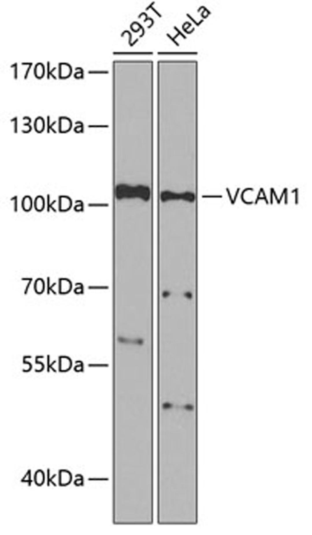 Western blot - VCAM1 Antibody (A0279)