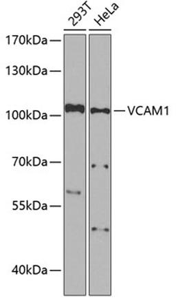 Western blot - VCAM1 Antibody (A0279)