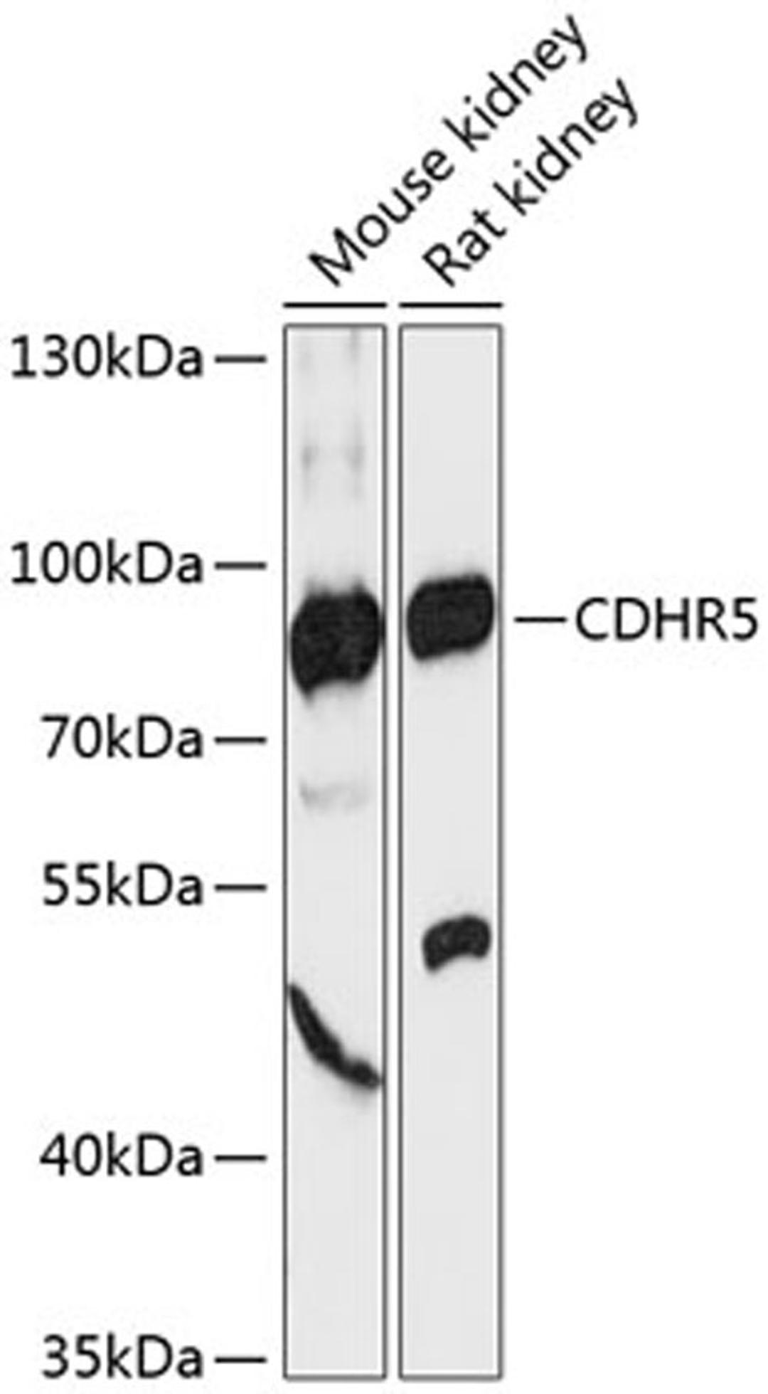 Western blot - CDHR5 antibody (A13850)