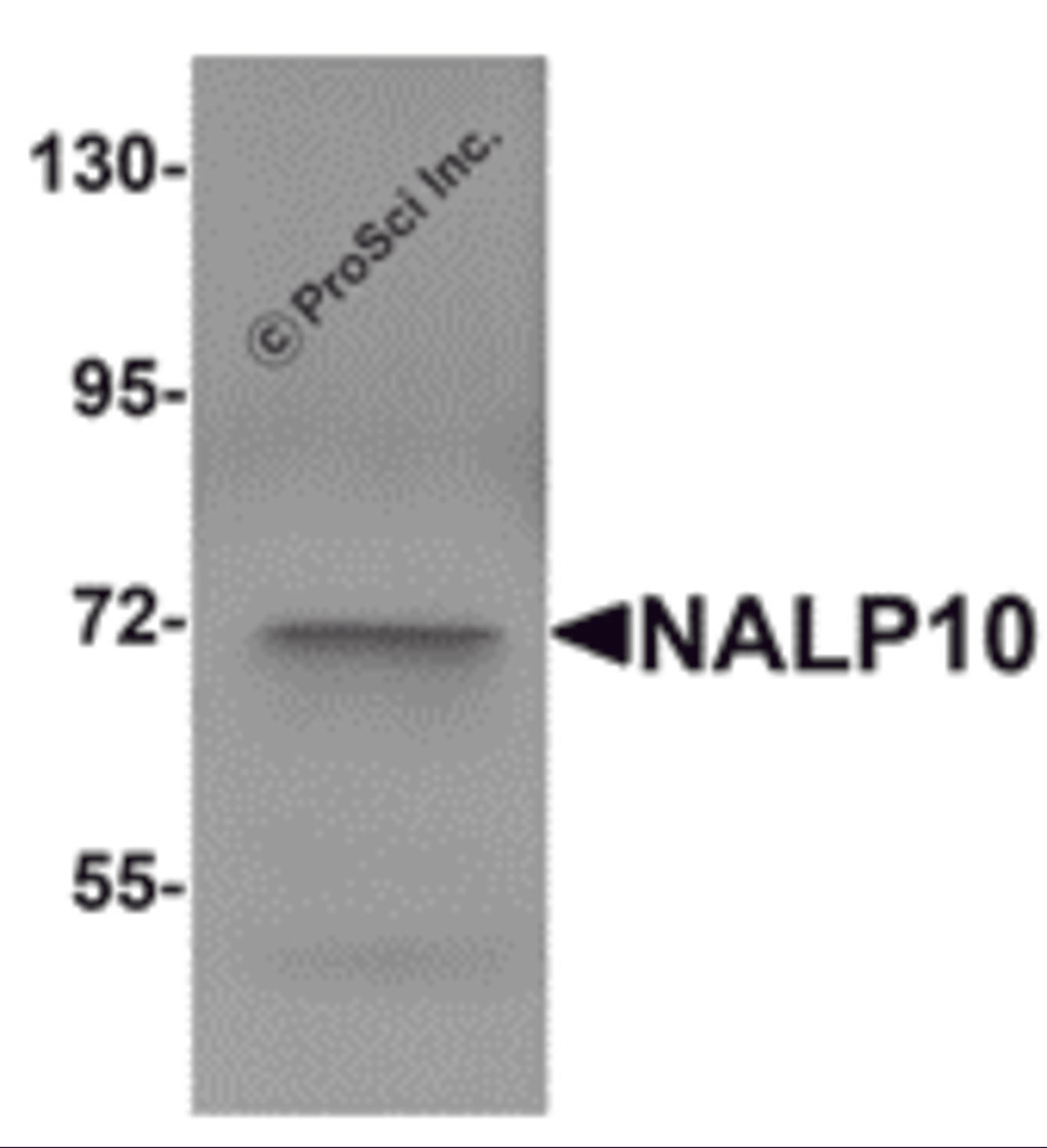 Western blot analysis of NALP10 in human brain tissue lysate with NALP10 antibody at 1 μg/mL.