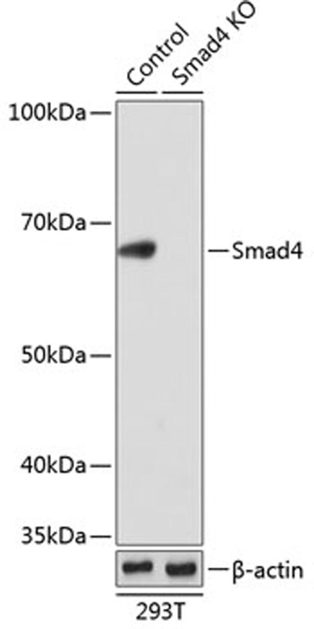 Western blot - Smad4 antibody (A19116)