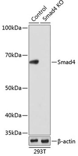 Western blot - Smad4 antibody (A19116)