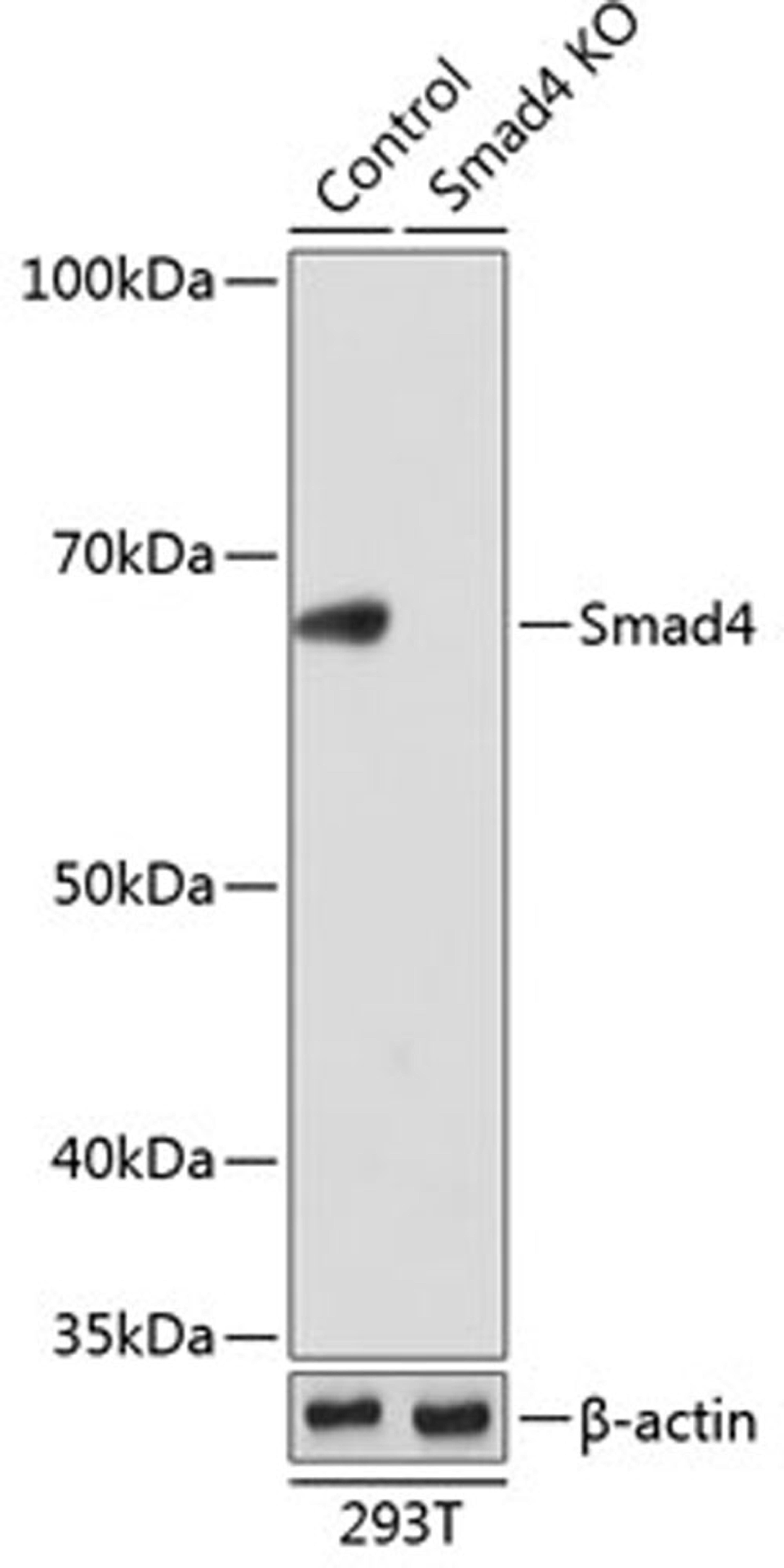 Western blot - Smad4 antibody (A19116)