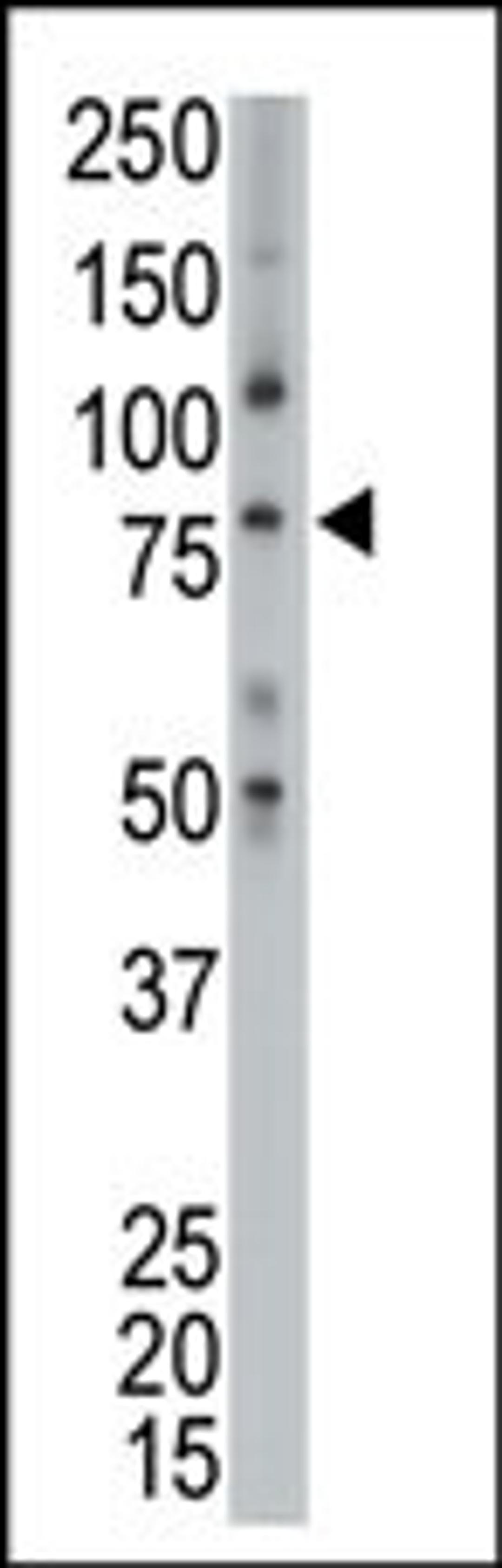 Antibody is used in Western blot to detect p100 in placenta lysate.