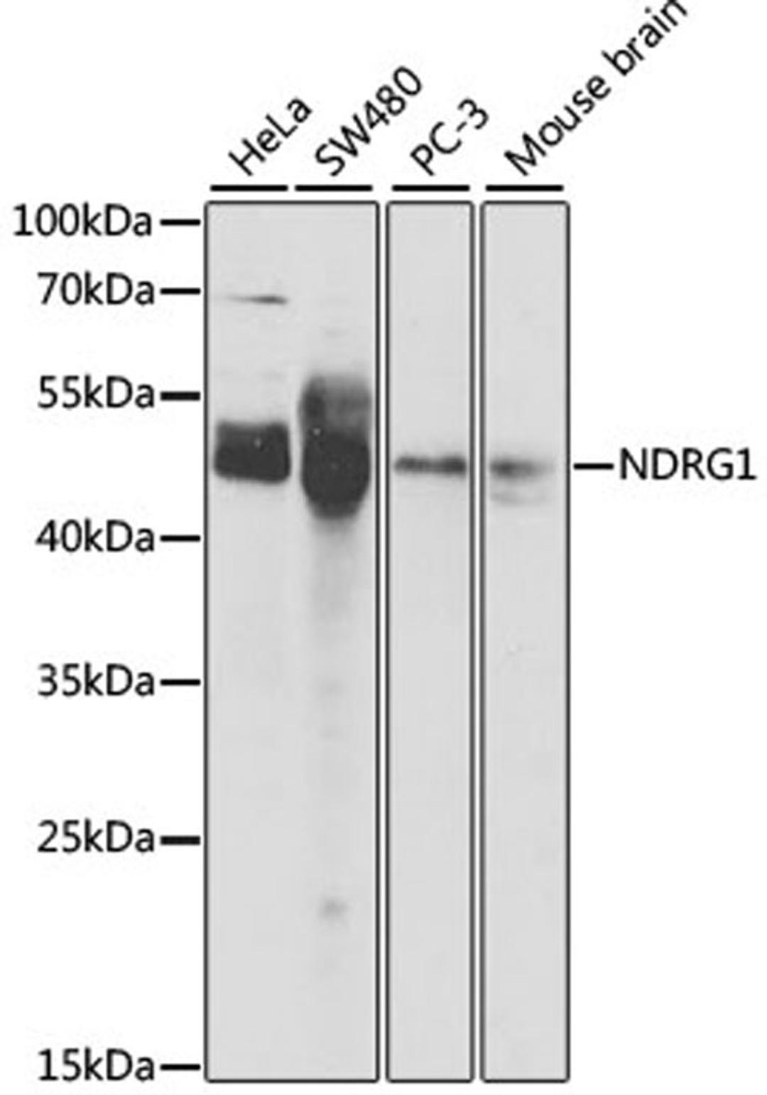 Western blot - NDRG1 antibody (A2142)