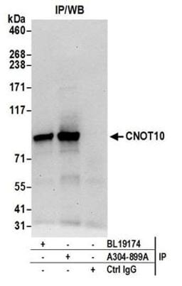 Detection of human CNOT10 by western blot of immunoprecipitates.