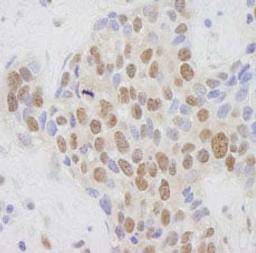 Detection of human MED1 by immunohistochemistry.