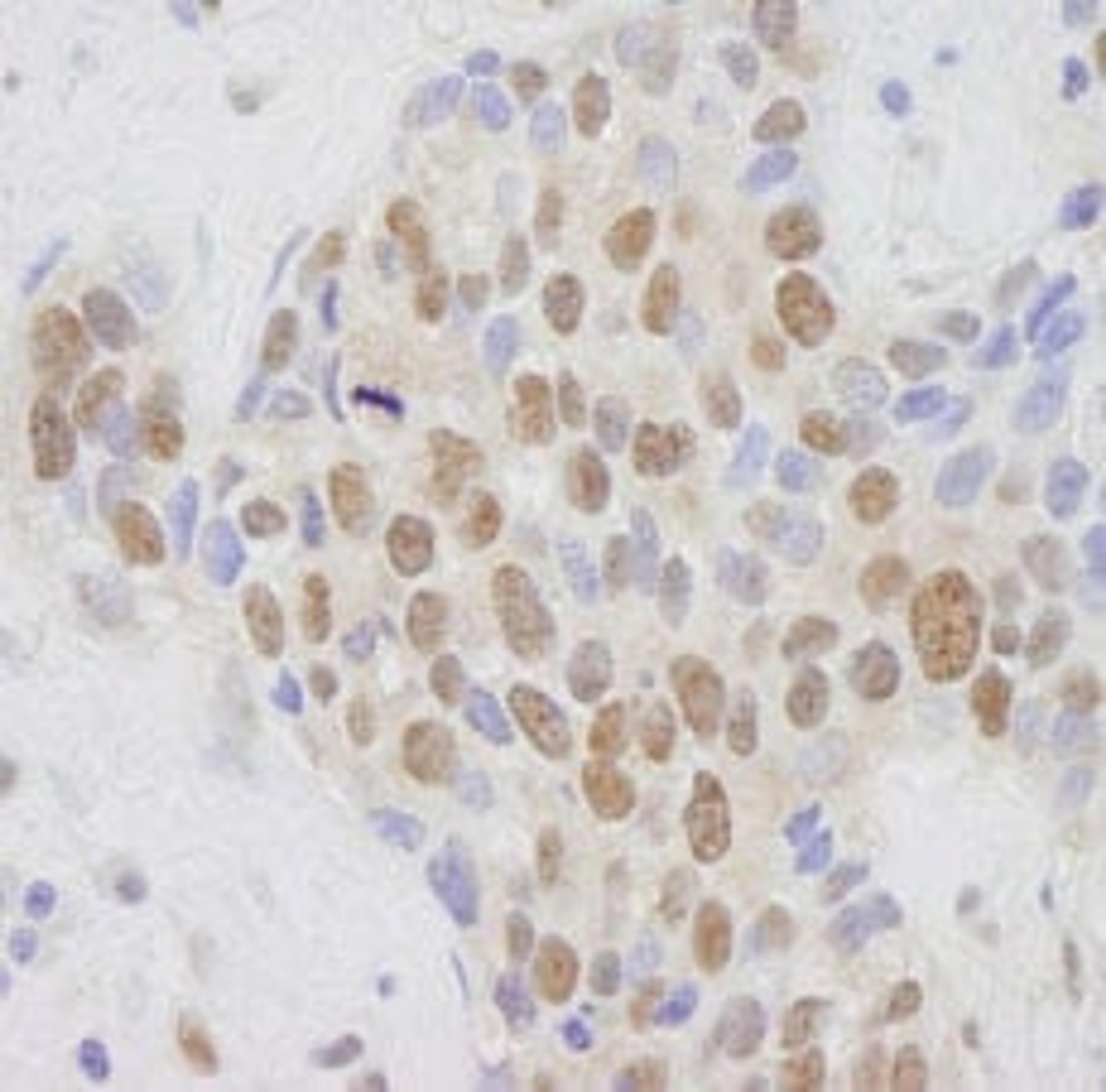 Detection of human MED1 by immunohistochemistry.