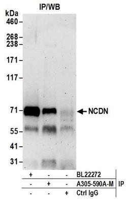 Detection of human NCDN by WB of IP.