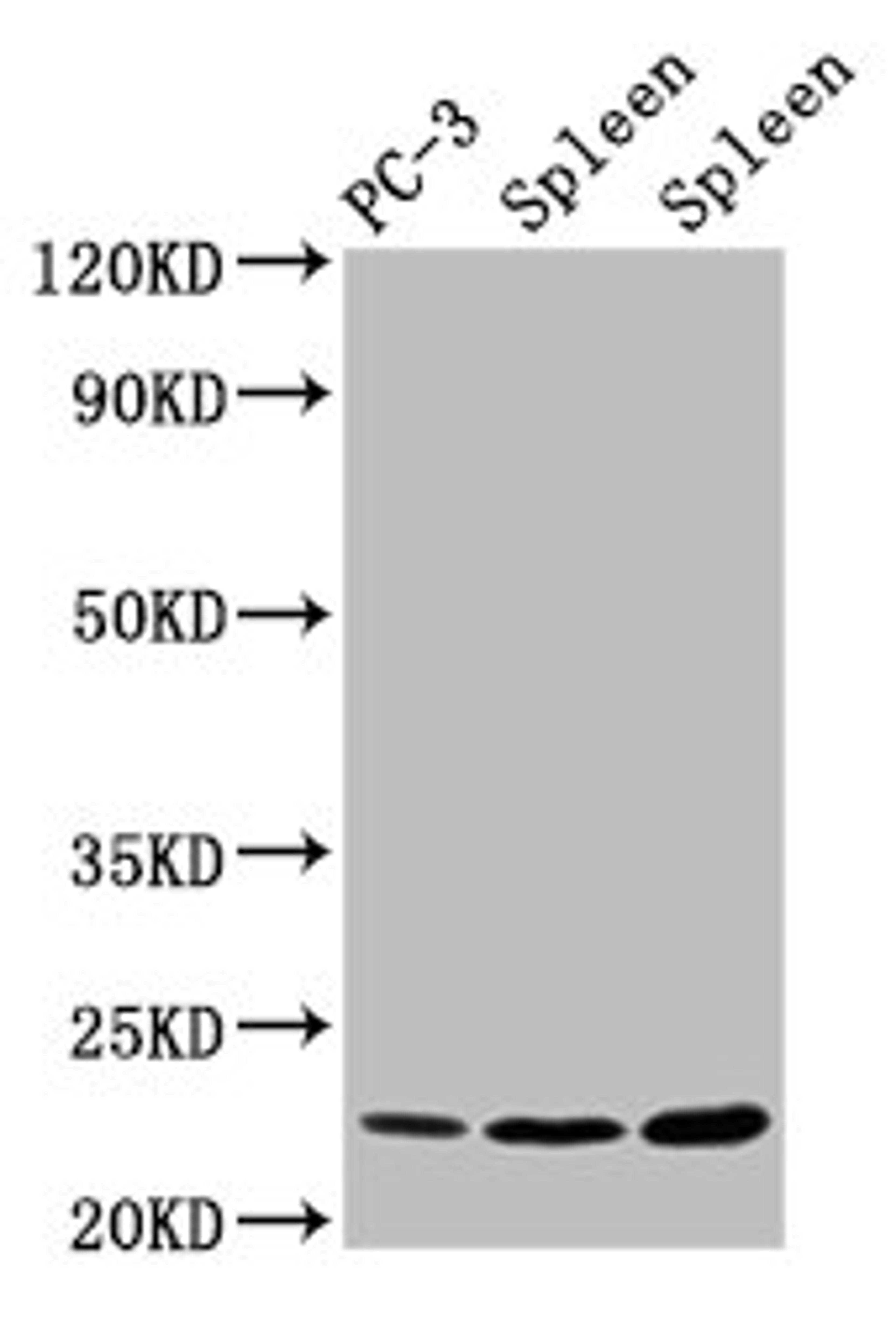 Western Blot. Positive WB detected in: PC-3 whole cell lysate, Rat spleen tissue, Mouse spleen tissue. All lanes: HIST1H1D antibody at 1.5µg/ml. Secondary. Goat polyclonal to rabbit IgG at 1/50000 dilution. Predicted band size: 23 kDa. Observed band size: 23 kDa