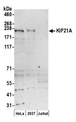 Detection of human KIF21A by western blot.