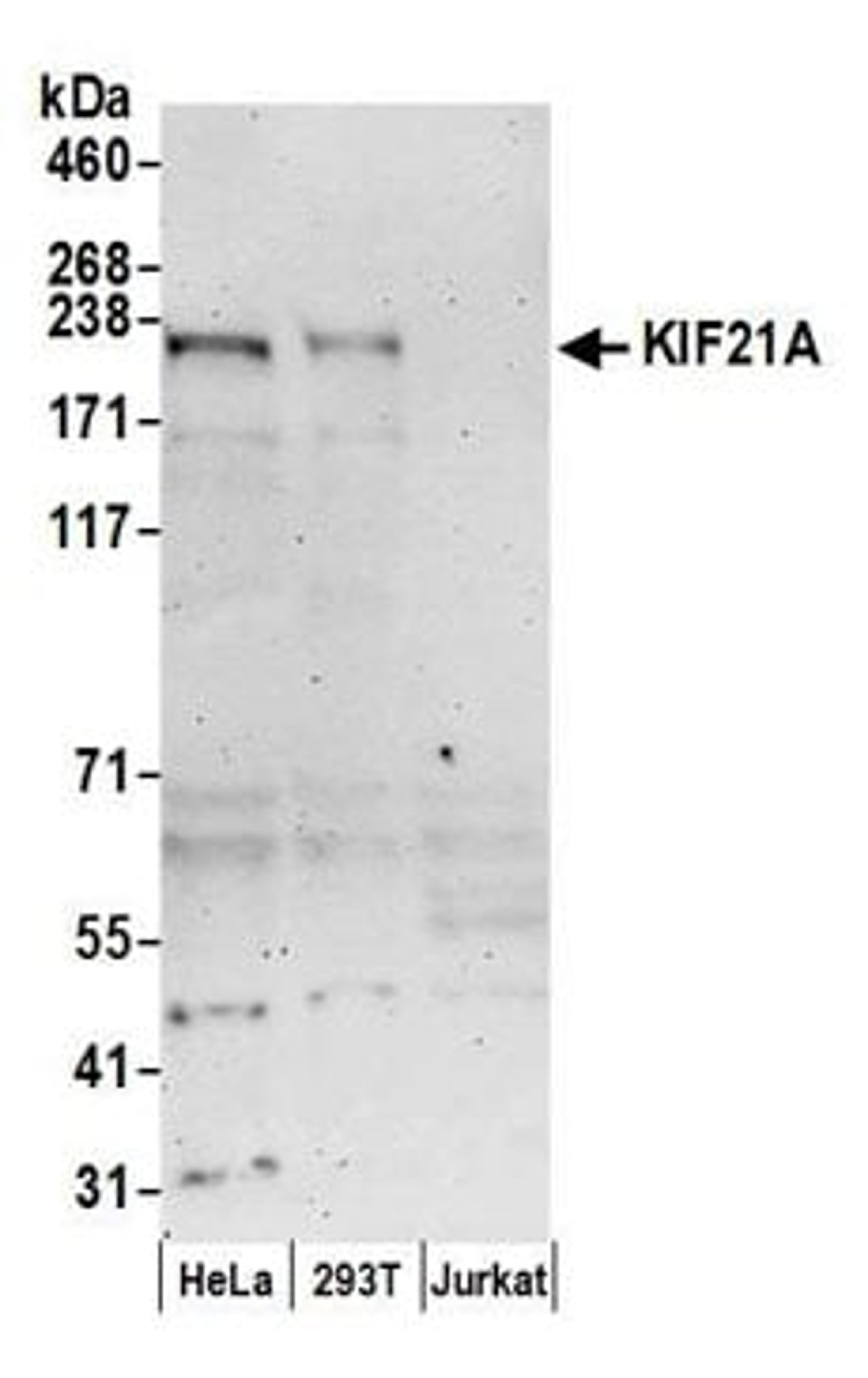 Detection of human KIF21A by western blot.