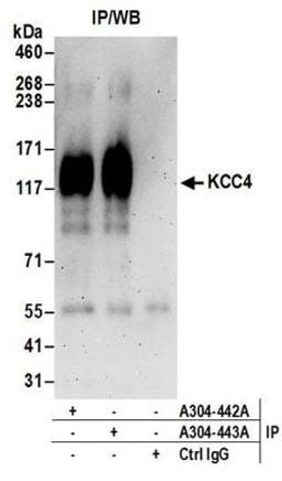 Detection of human KCC4 by western blot of immunoprecipitates.