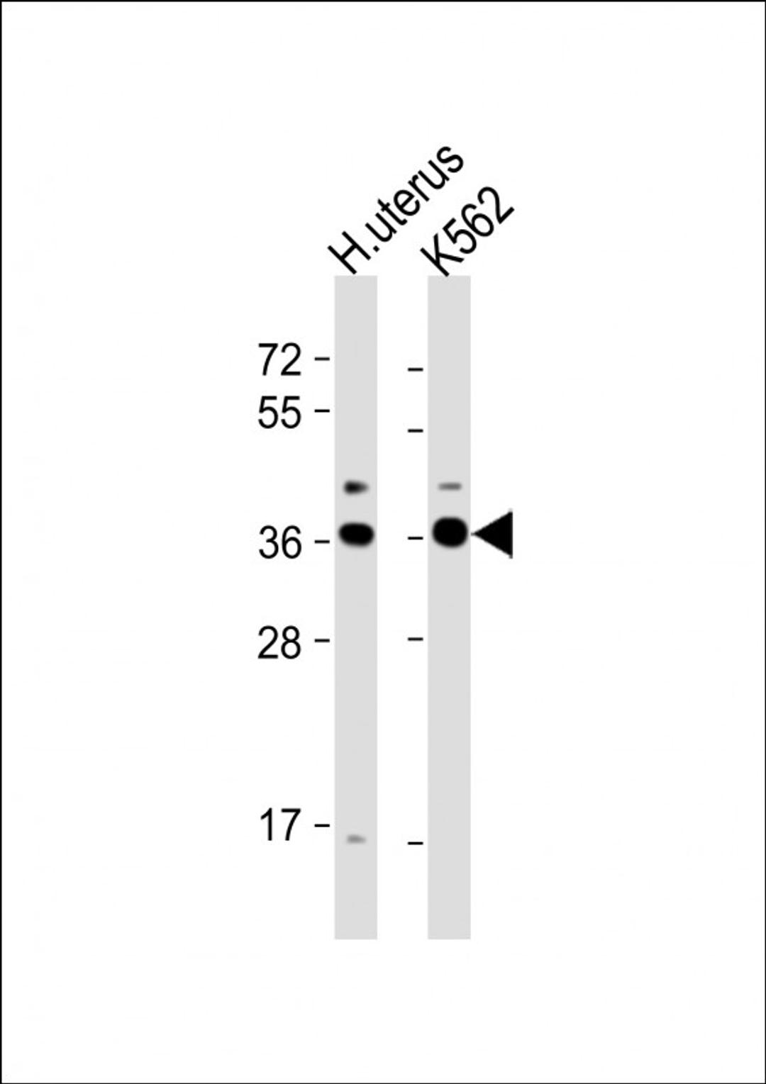 Western Blot at 1:1000 dilution Lane 1: human uterus lysate Lane 2: K562 whole cell lysate Lysates/proteins at 20 ug per lane.