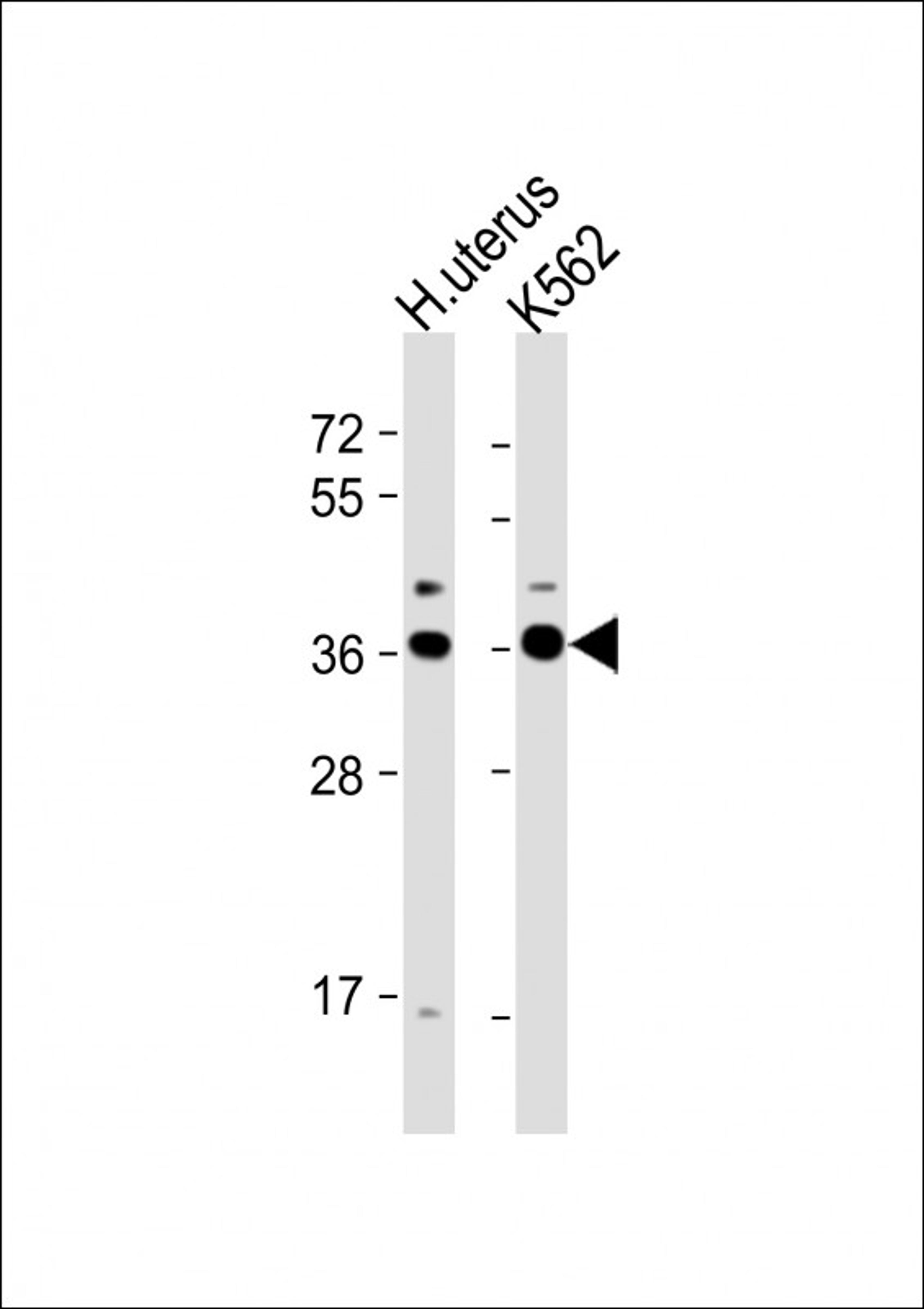 Western Blot at 1:1000 dilution Lane 1: human uterus lysate Lane 2: K562 whole cell lysate Lysates/proteins at 20 ug per lane.