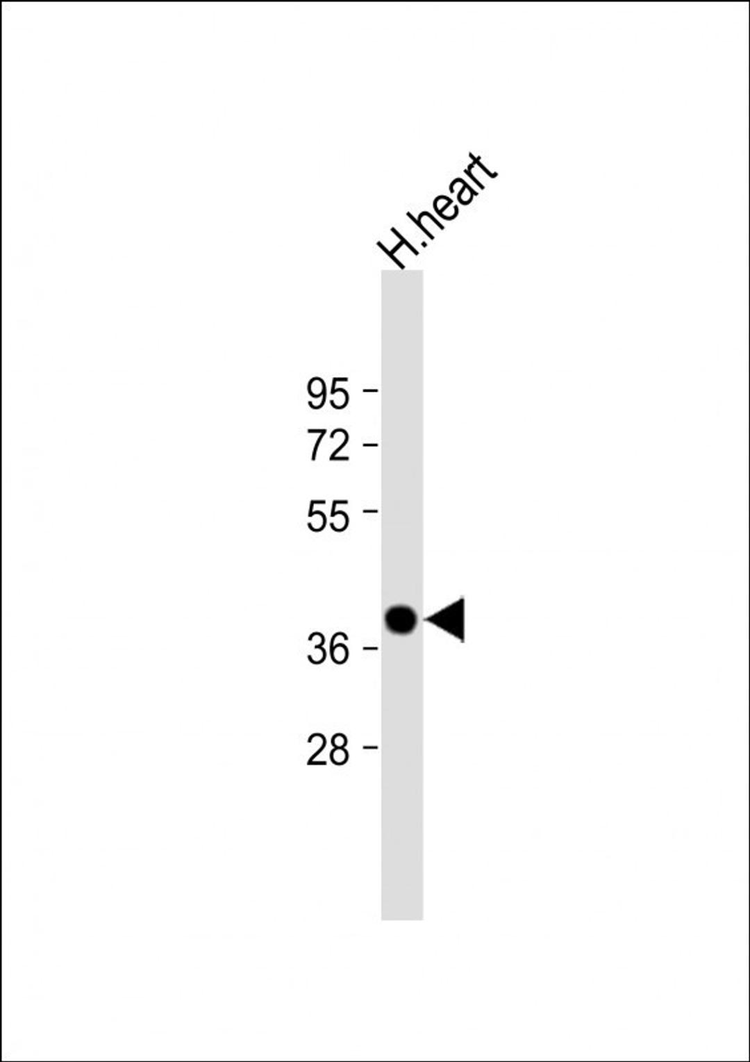 Western Blot at 1:2000 dilution + human heart lysate Lysates/proteins at 20 ug per lane.