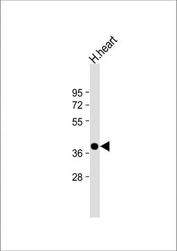 Western Blot at 1:2000 dilution + human heart lysate Lysates/proteins at 20 ug per lane.