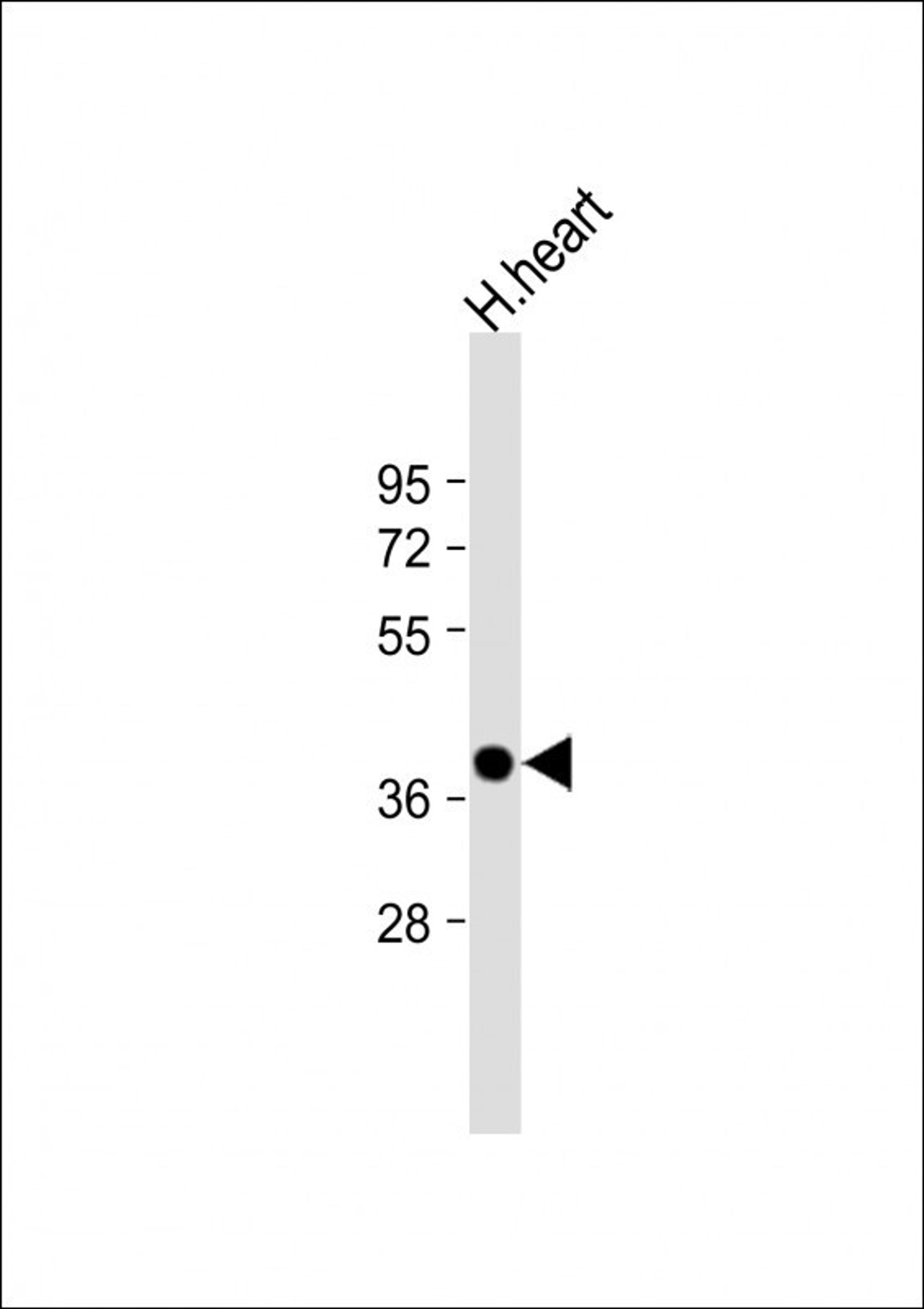 Western Blot at 1:2000 dilution + human heart lysate Lysates/proteins at 20 ug per lane.