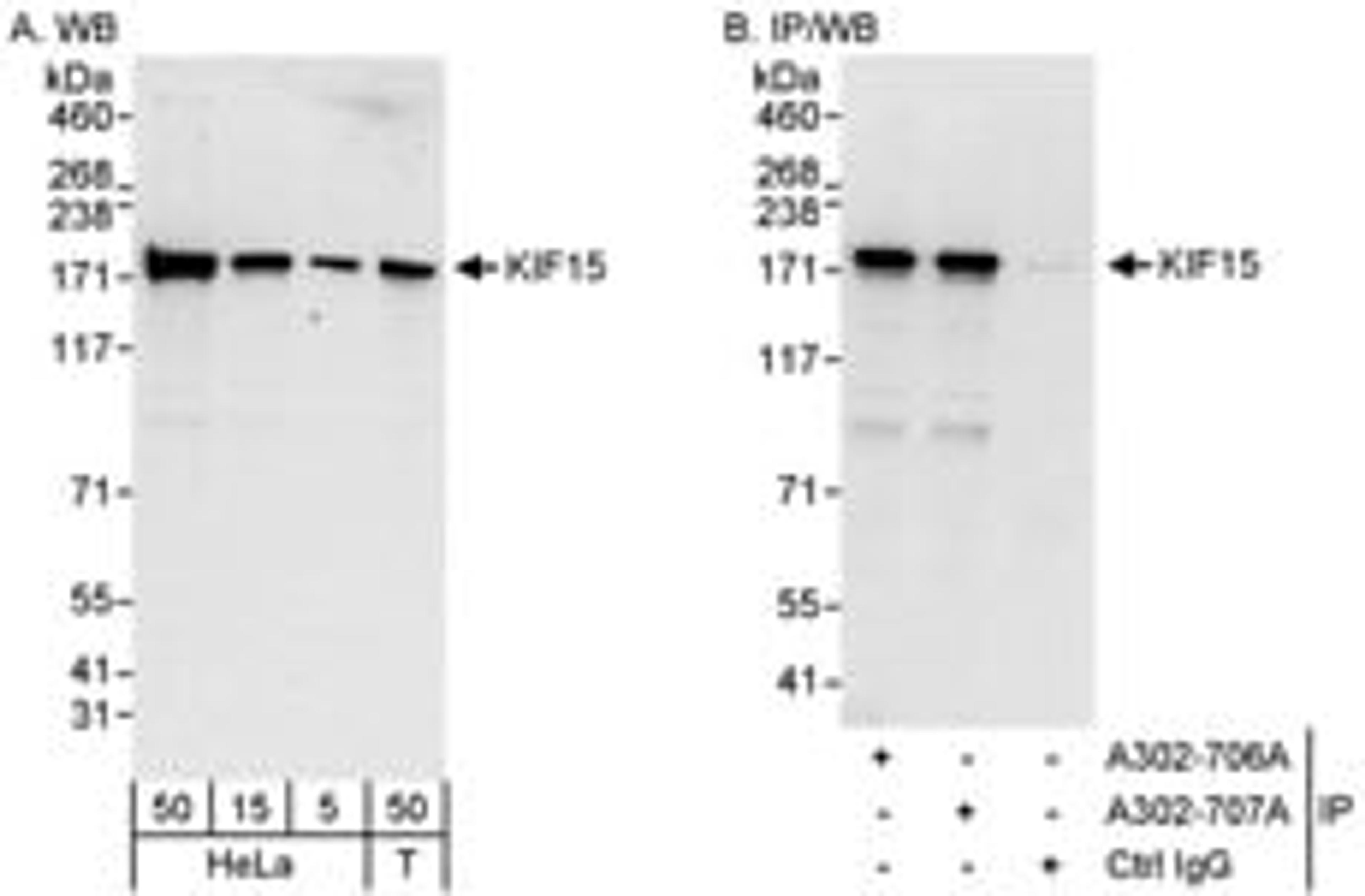 Detection of human KIF15 by western blot and immunoprecipitation.