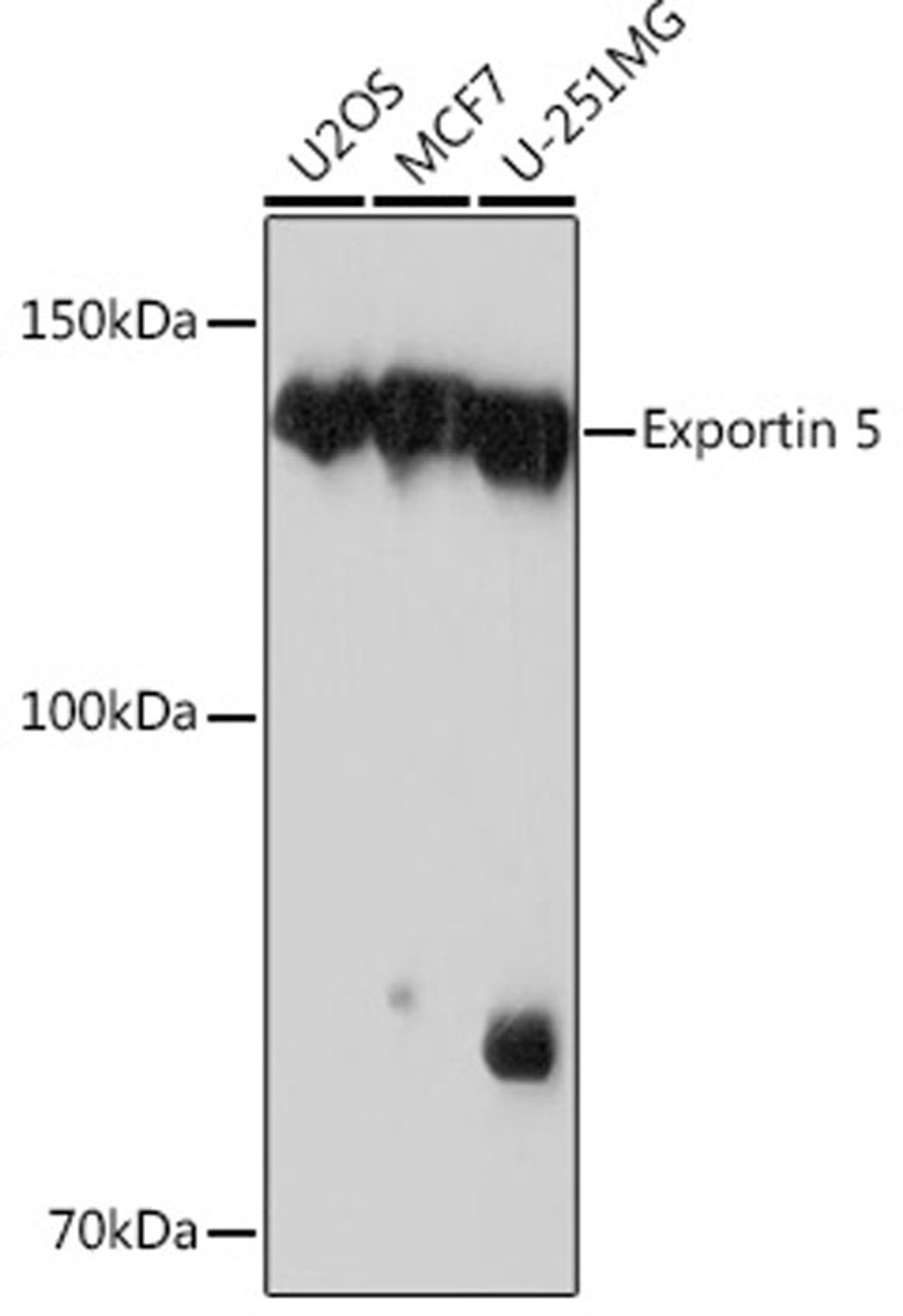 Western blot - Exportin 5 Rabbit mAb (A3813)