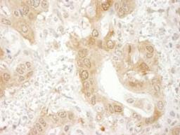 Detection of human Paxillin by immunohistochemistry.