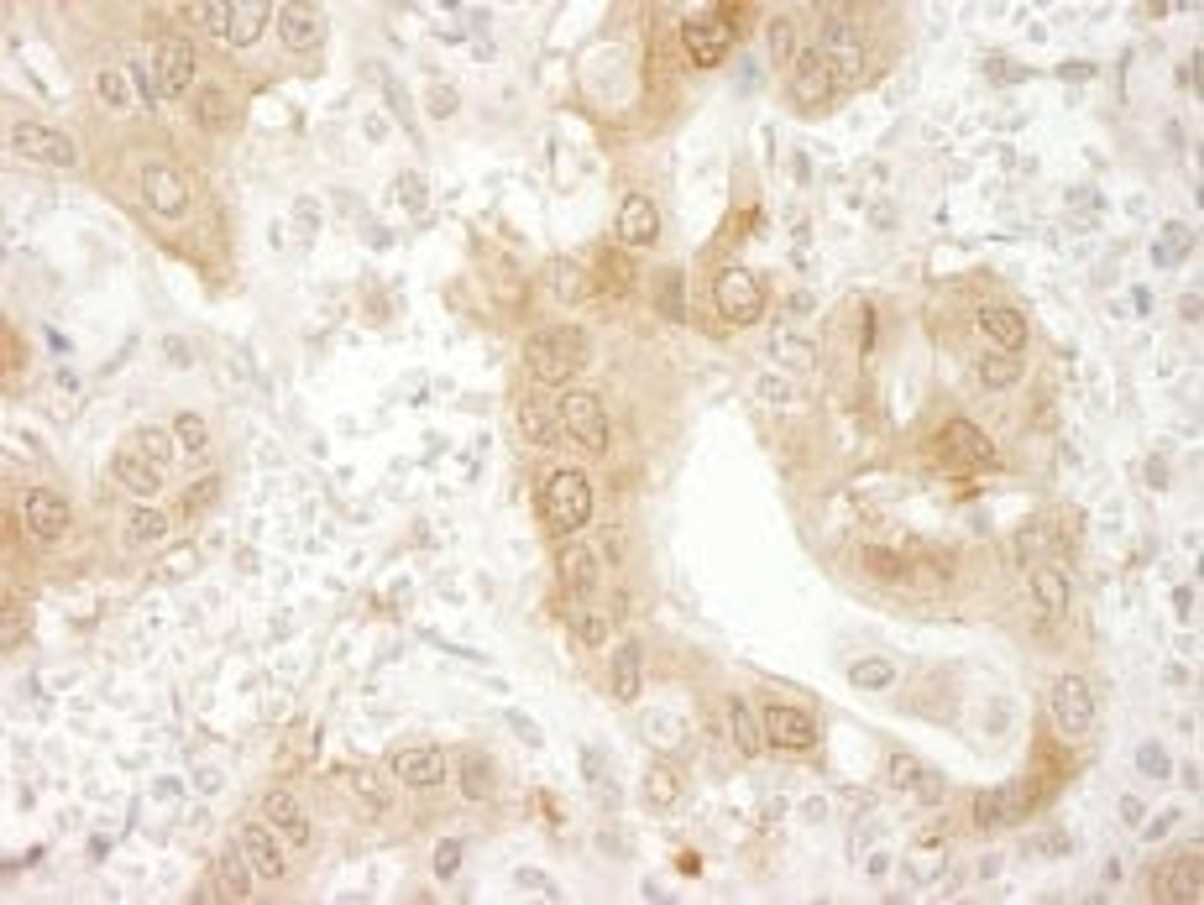 Detection of human Paxillin by immunohistochemistry.