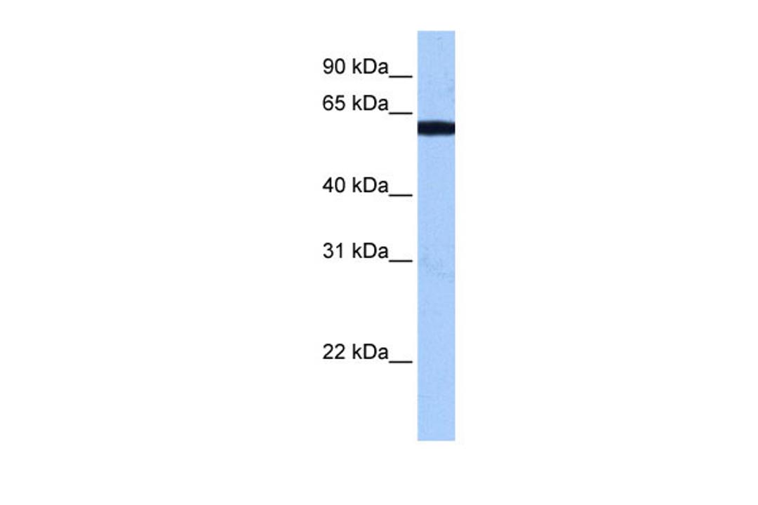 Antibody used in WB on Human Brain at 0.2-1 ug/ml.