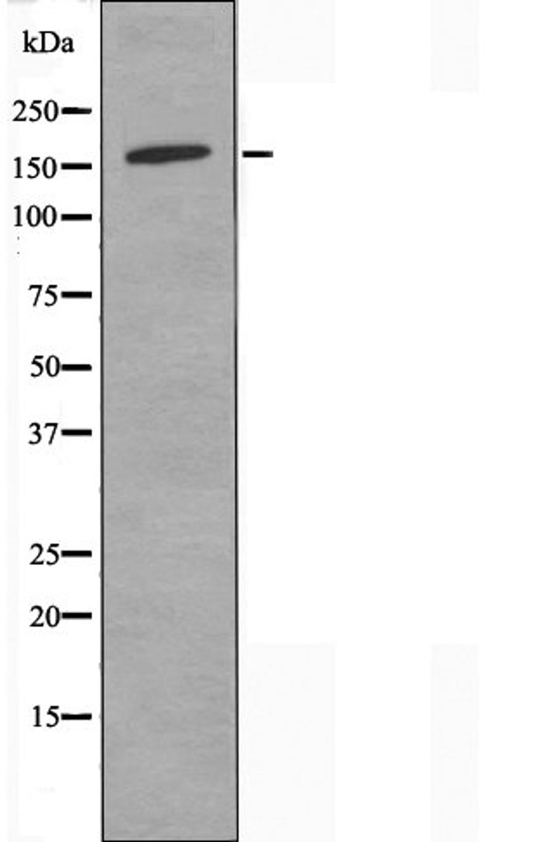 Western blot analysis of Jurkat cells using Collagen IV Alpha2 antibody