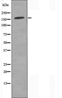 Western blot analysis of Jurkat cells using Collagen IV Alpha2 antibody