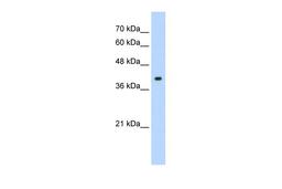 Antibody used in WB on Human HepG2 at 1.25 ug/ml.