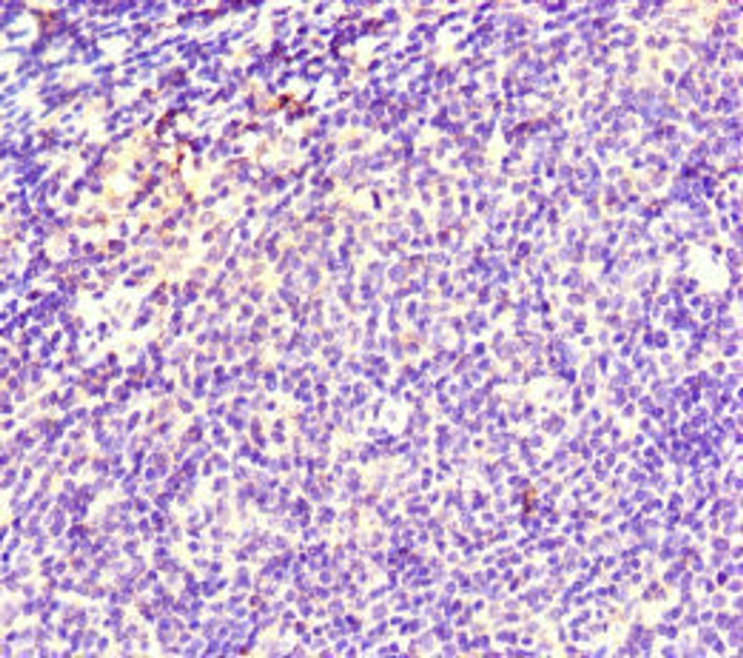 Immunohistochemistry of paraffin-embedded human lymph node tissue using CSB-PA023313LA01HU at dilution of 1:100