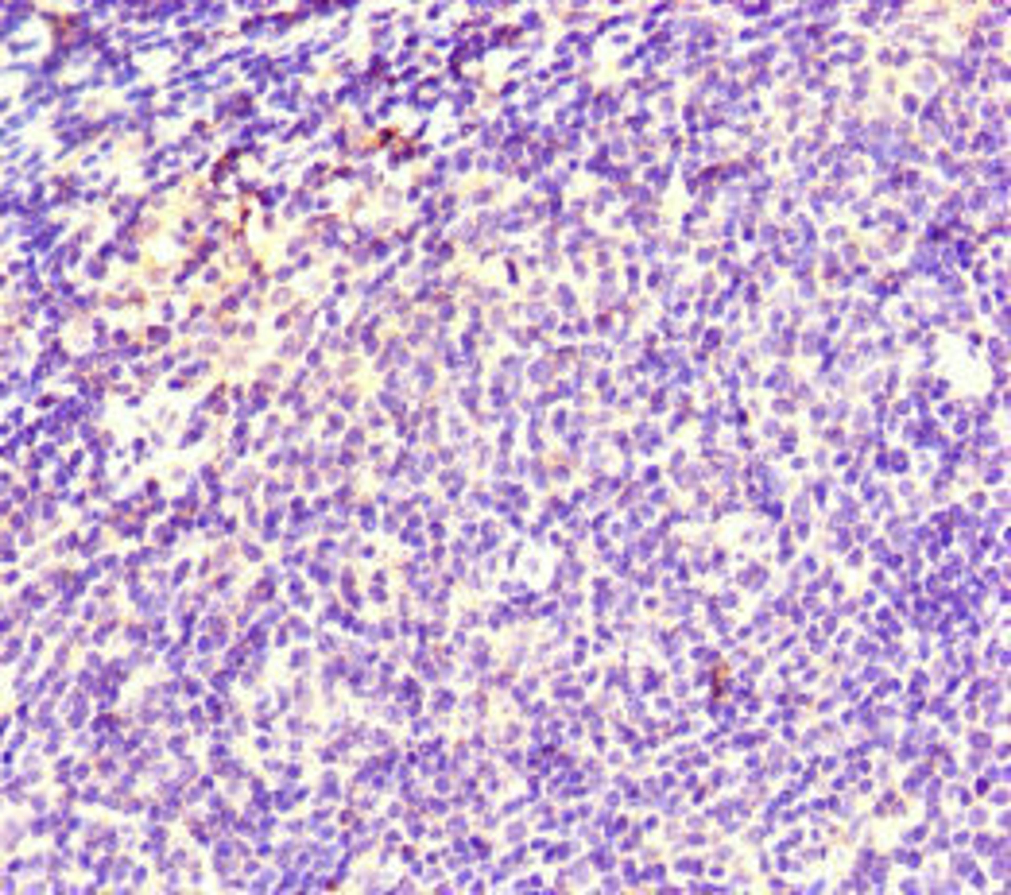 Immunohistochemistry of paraffin-embedded human lymph node tissue using CSB-PA023313LA01HU at dilution of 1:100