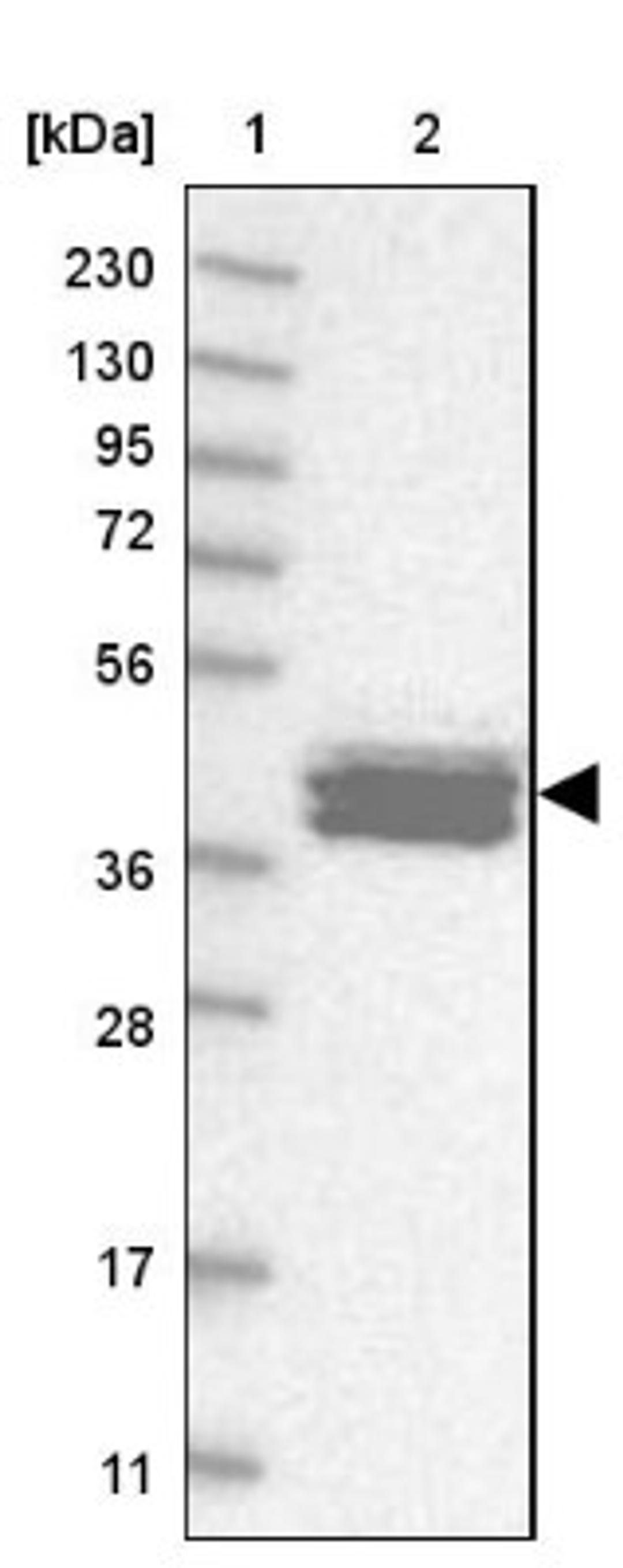 Western Blot: Calsequestrin 2 Antibody [NBP1-87304] - Lane 1: Marker [kDa] 230, 130, 95, 72, 56, 36, 28, 17, 11<br/>Lane 2: Human cell line RT-4