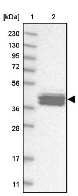 Western Blot: Calsequestrin 2 Antibody [NBP1-87304] - Lane 1: Marker [kDa] 230, 130, 95, 72, 56, 36, 28, 17, 11<br/>Lane 2: Human cell line RT-4