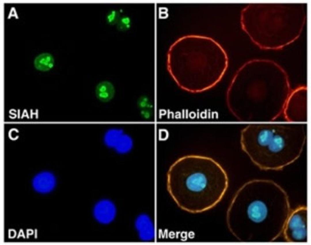 Immunocytochemistry/Immunofluorescence: SIAH2 Antibody (24E6H3) [NB110-88113] - Immunofluorescent staining of SIAH in ovarian carcinoma (OVCR3)cells using NB110-88113.