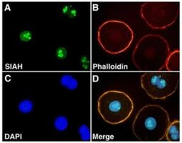 Immunocytochemistry/Immunofluorescence: SIAH2 Antibody (24E6H3) [NB110-88113] - Immunofluorescent staining of SIAH in ovarian carcinoma (OVCR3)cells using NB110-88113.