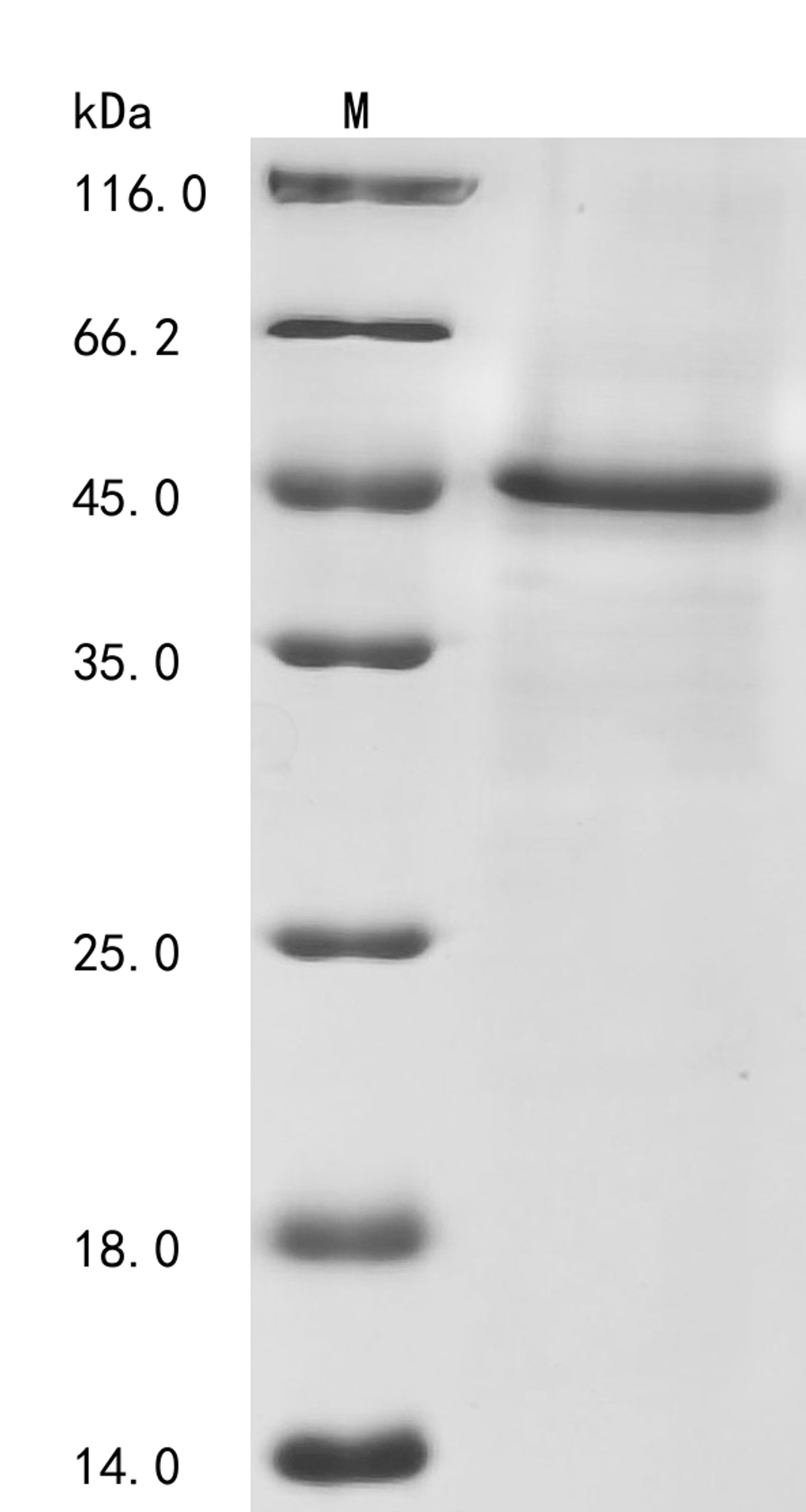 (Tris-Glycine gel) Discontinuous SDS-PAGE (reduced) with 5% enrichment gel and 15% separation gel.