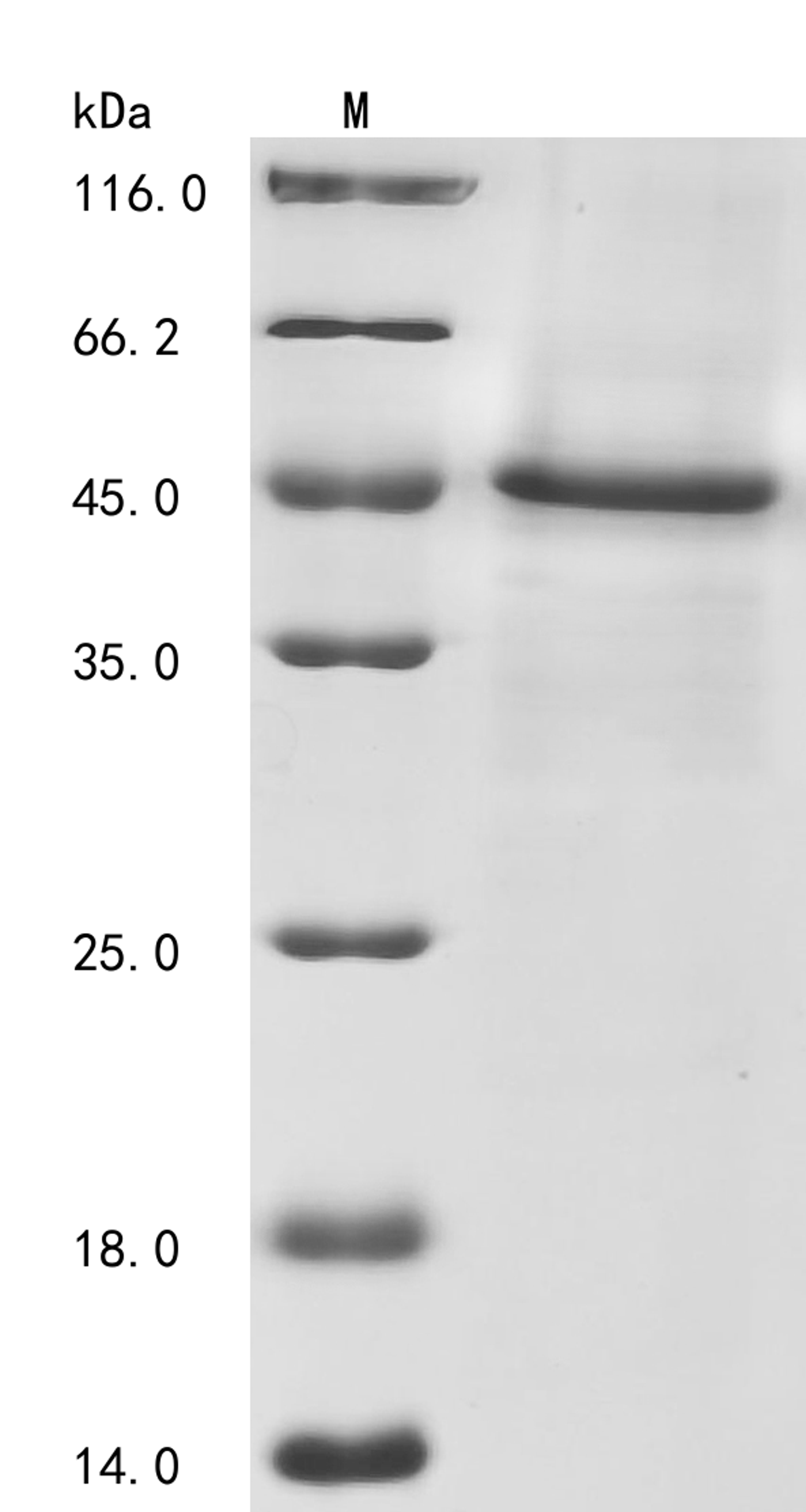 (Tris-Glycine gel) Discontinuous SDS-PAGE (reduced) with 5% enrichment gel and 15% separation gel.