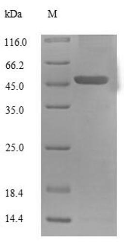 (Tris-Glycine gel) Discontinuous SDS-PAGE (reduced) with 5% enrichment gel and 15% separation gel.