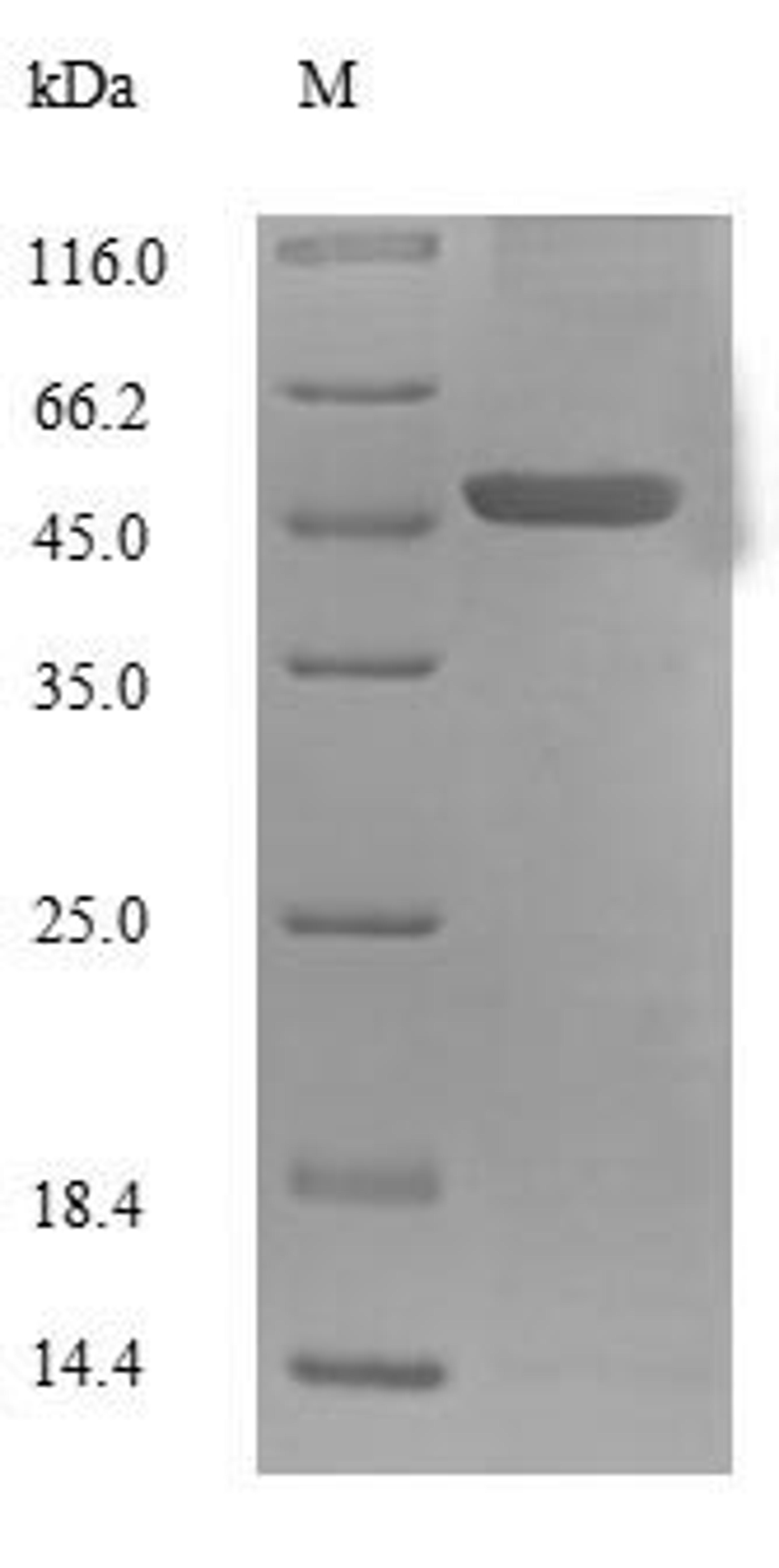 (Tris-Glycine gel) Discontinuous SDS-PAGE (reduced) with 5% enrichment gel and 15% separation gel.