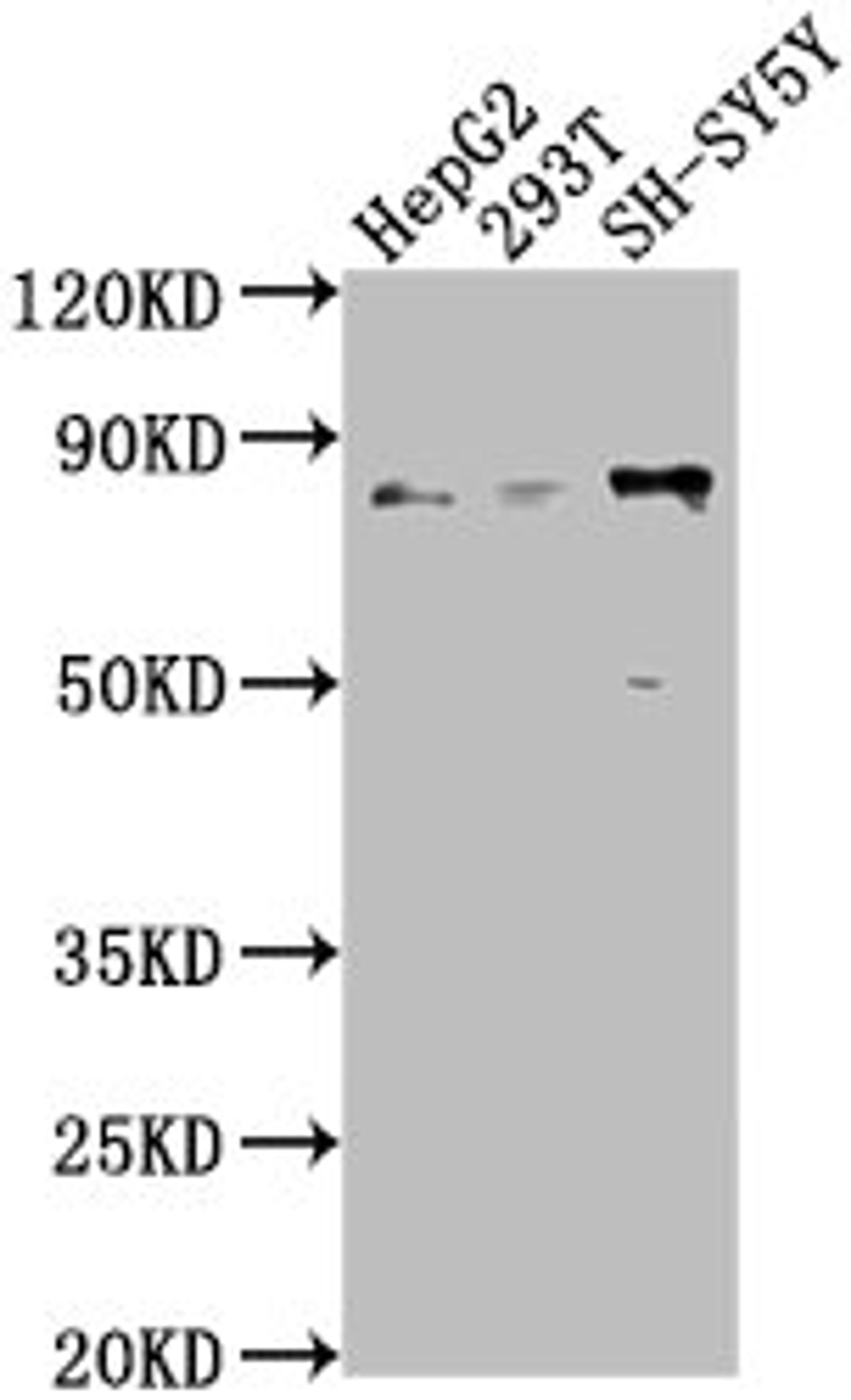 Western Blot. Positive WB detected in: HepG2 whole cell lysate, 293T whole cell lysate, SH-SY5Y whole cell lysate. All lanes: Uncharacterized protein antibody at 1:1000. Secondary. Goat polyclonal to rabbit IgG at 1/50000 dilution. Predicted band size: 84 kDa. Observed band size: 84 kDa. 