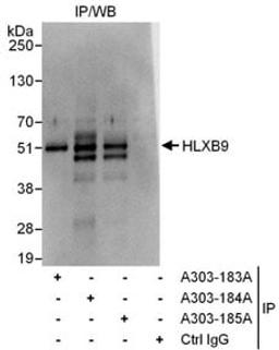 Detection of human HLXB9 by western blot of immunoprecipitates.