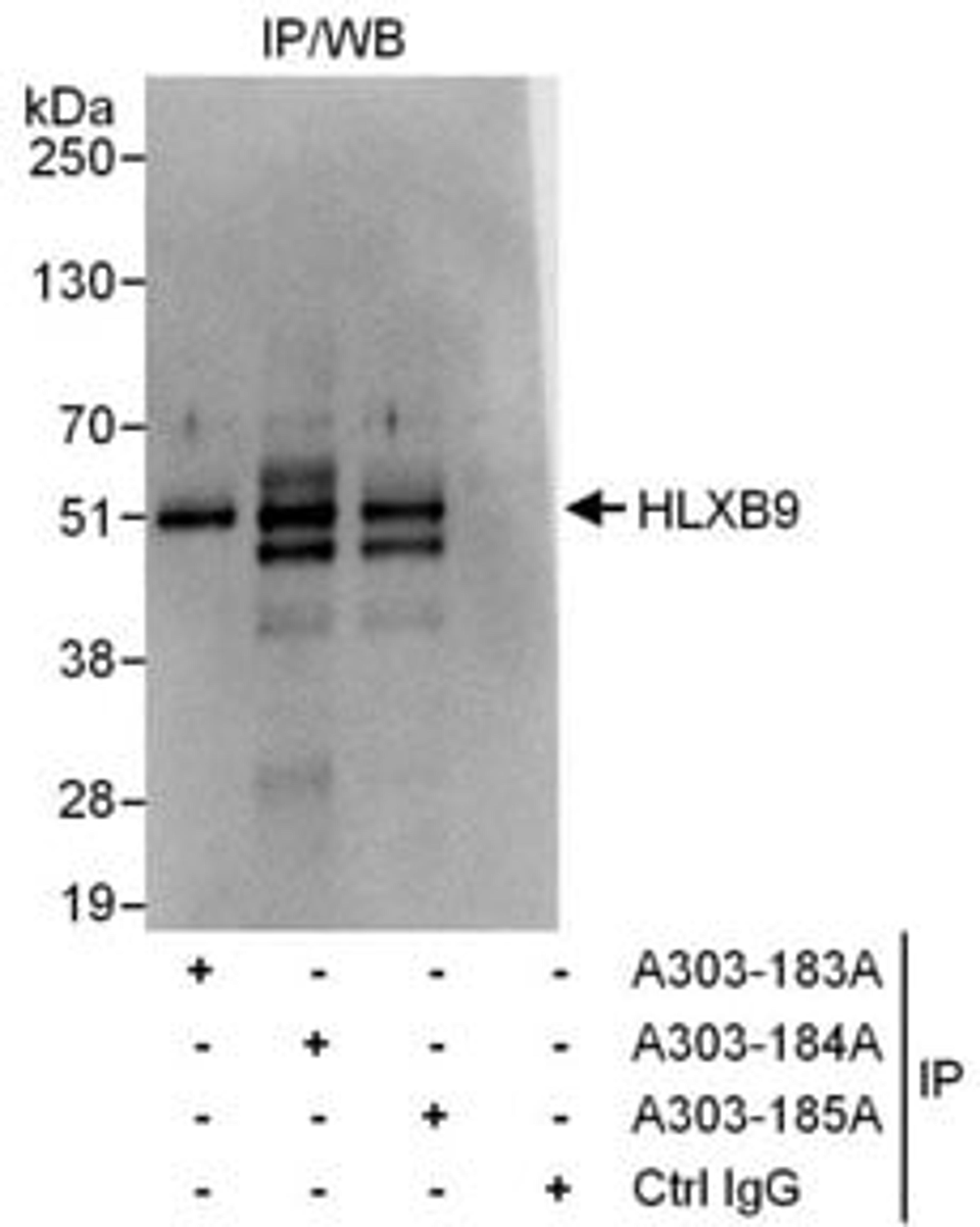 Detection of human HLXB9 by western blot of immunoprecipitates.