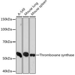 Western blot - Thromboxane synthase Rabbit mAb (A5173)