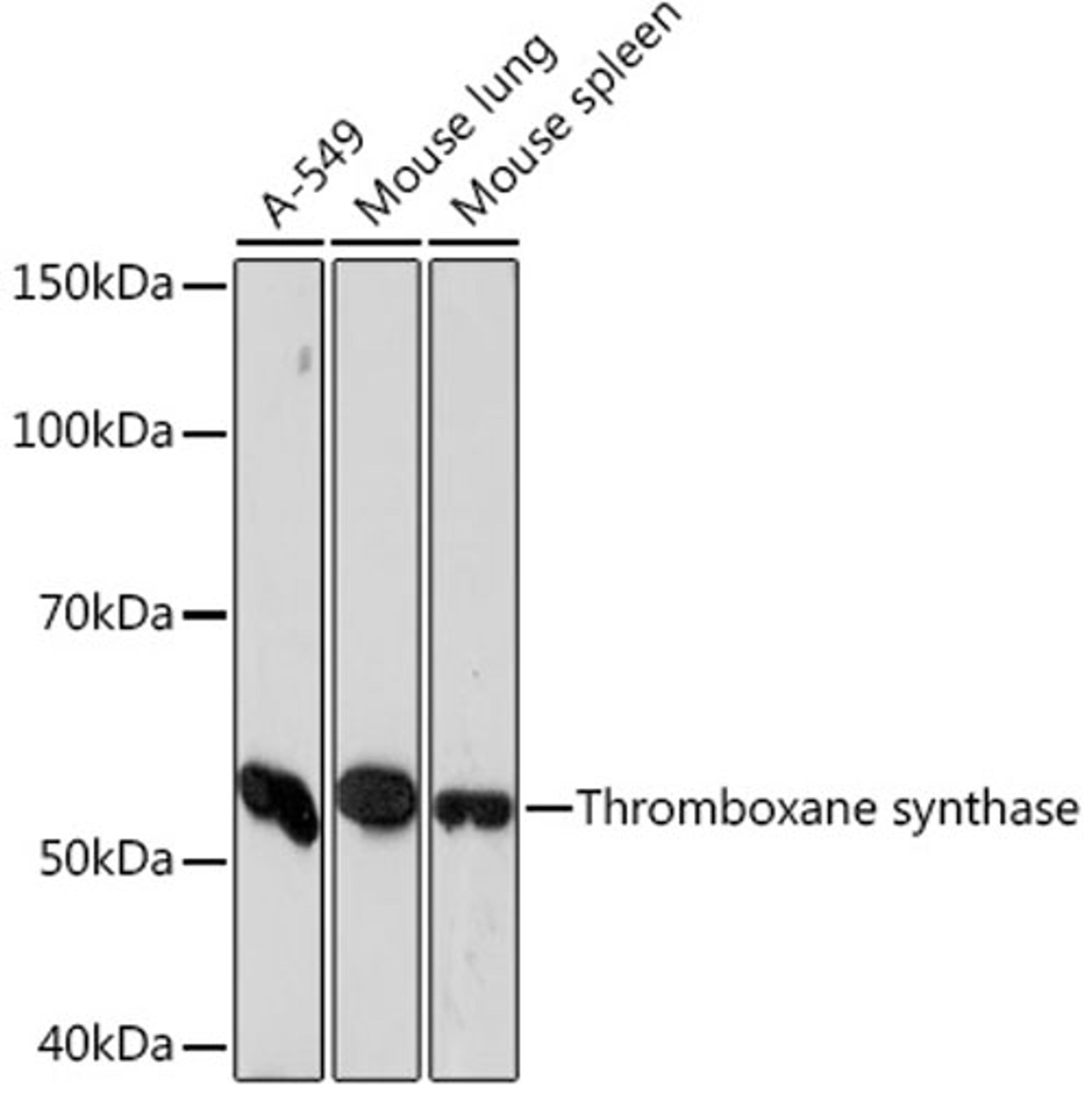 Western blot - Thromboxane synthase Rabbit mAb (A5173)