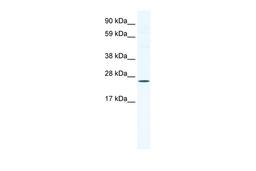 Antibody used in WB on Mouse NIH-3T3 at 1.25 ug/ml.