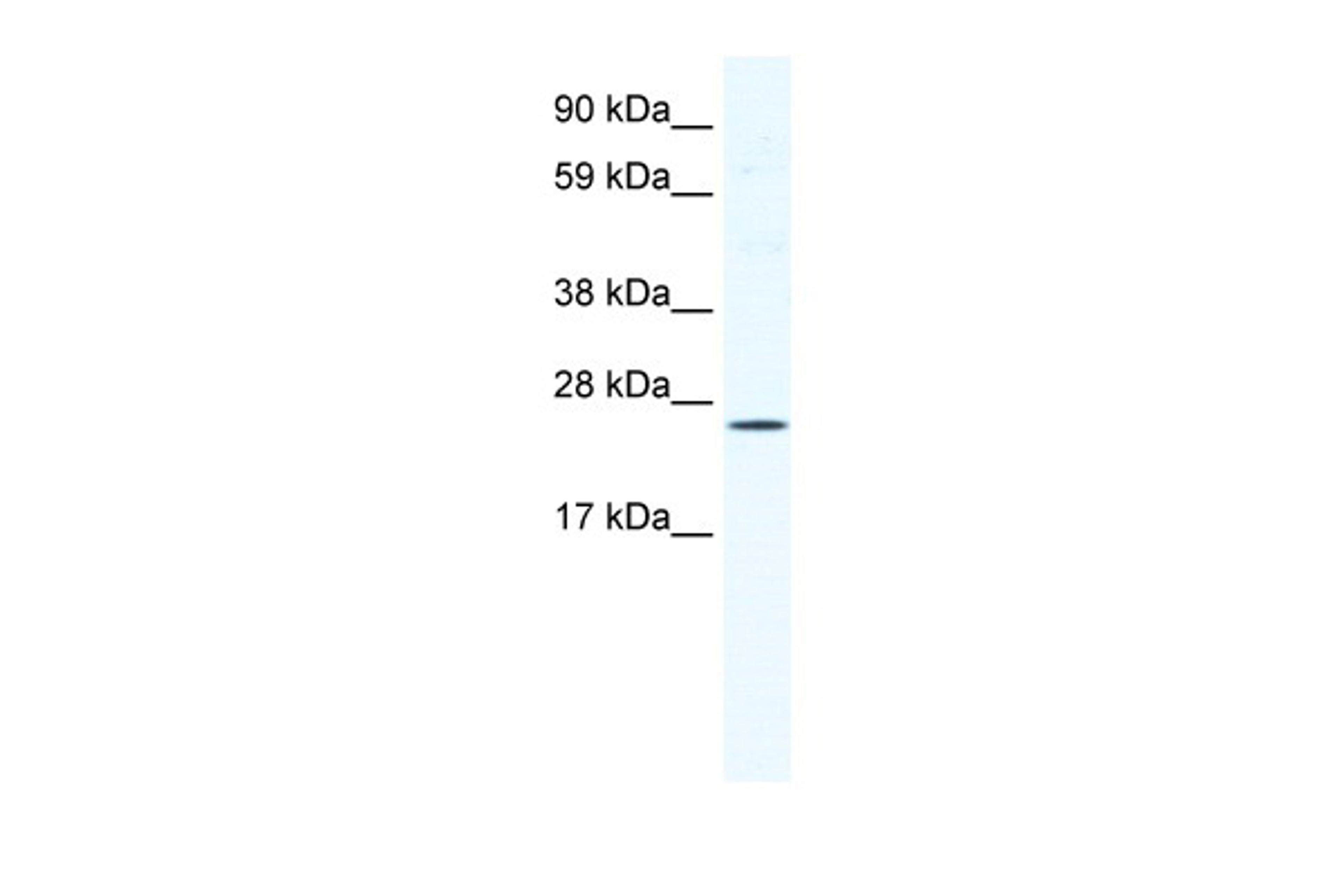 Antibody used in WB on Mouse NIH-3T3 at 1.25 ug/ml.