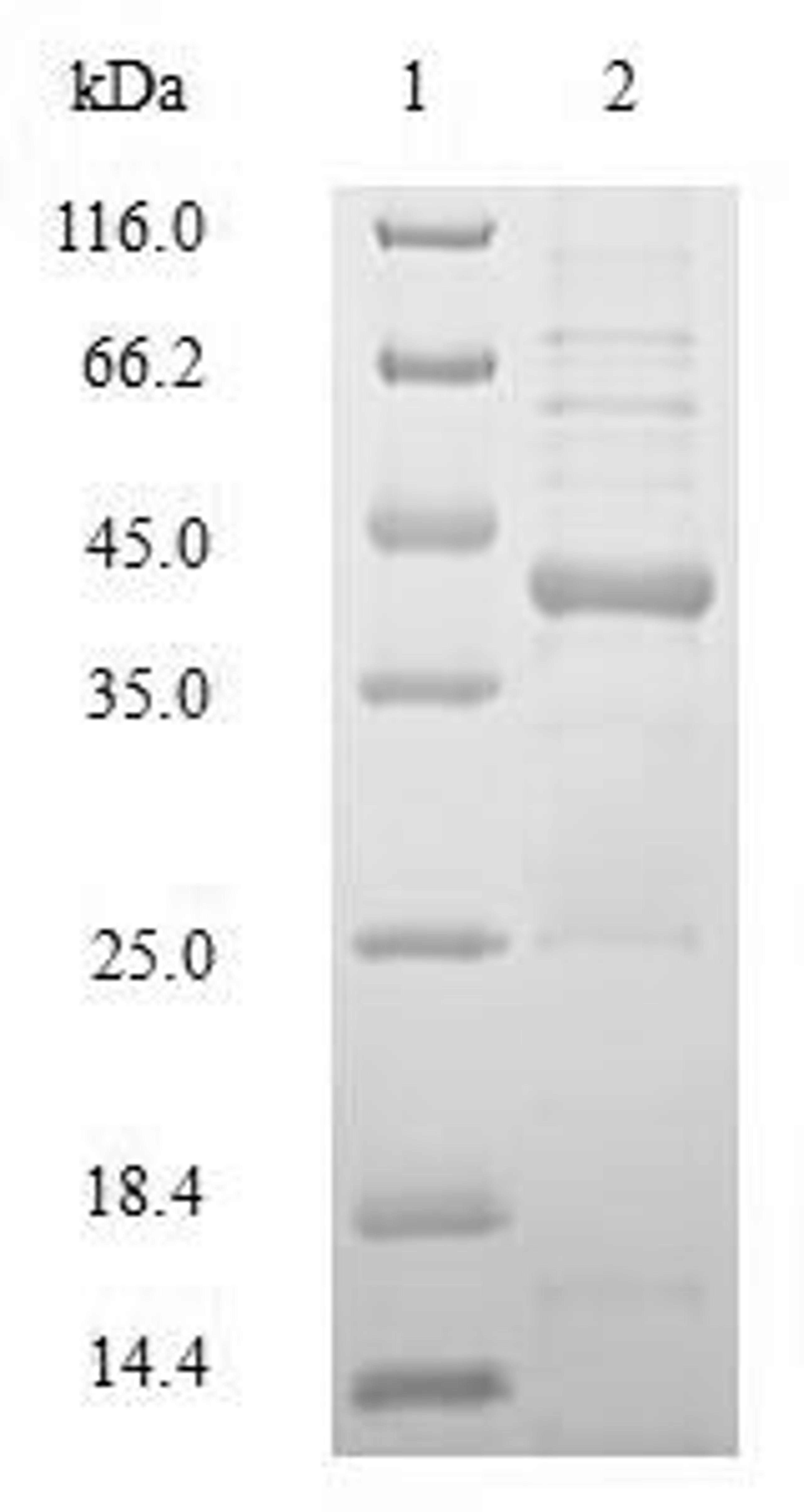 (Tris-Glycine gel) Discontinuous SDS-PAGE (reduced) with 5% enrichment gel and 15% separation gel.